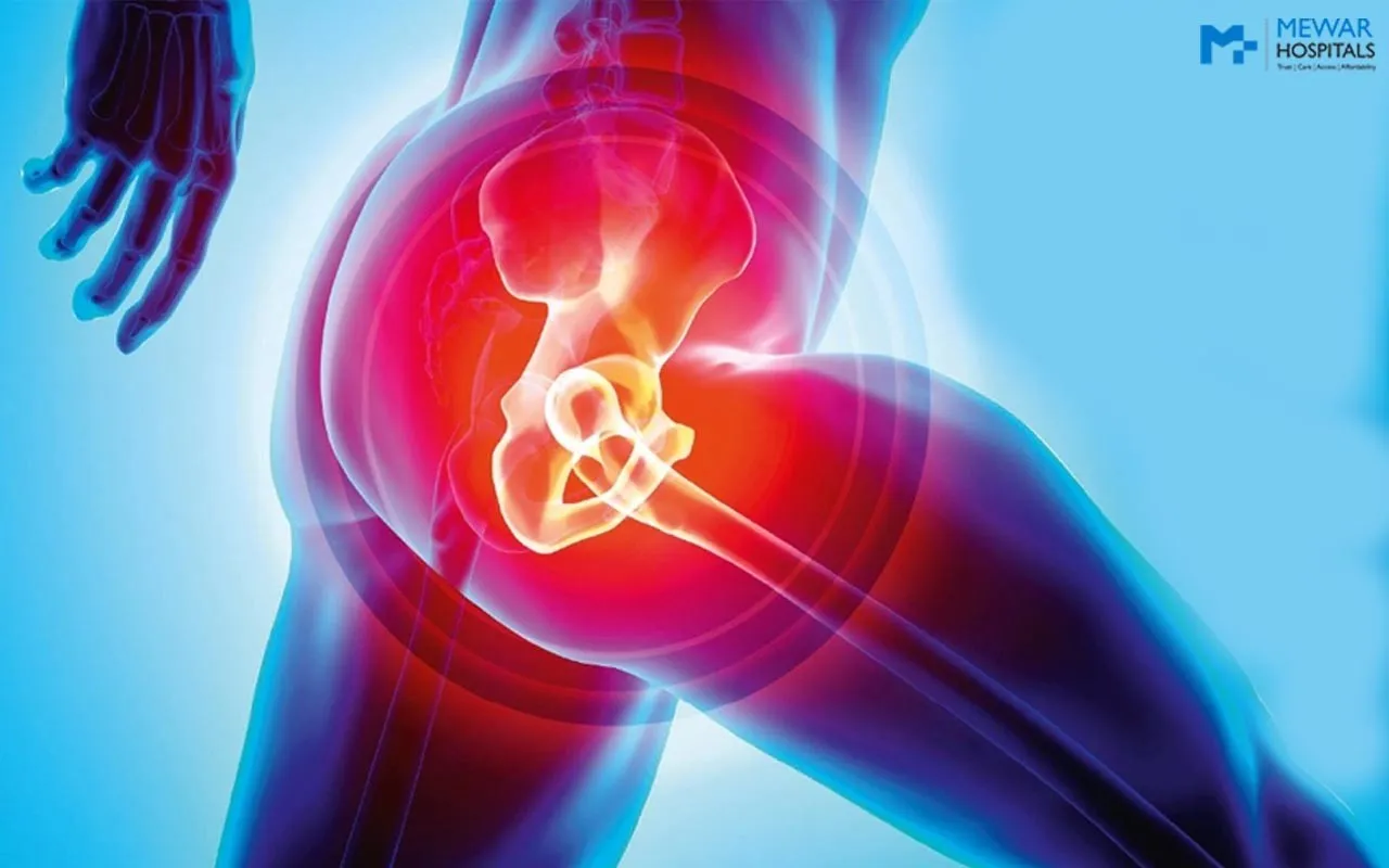 Hip Replacement image 1